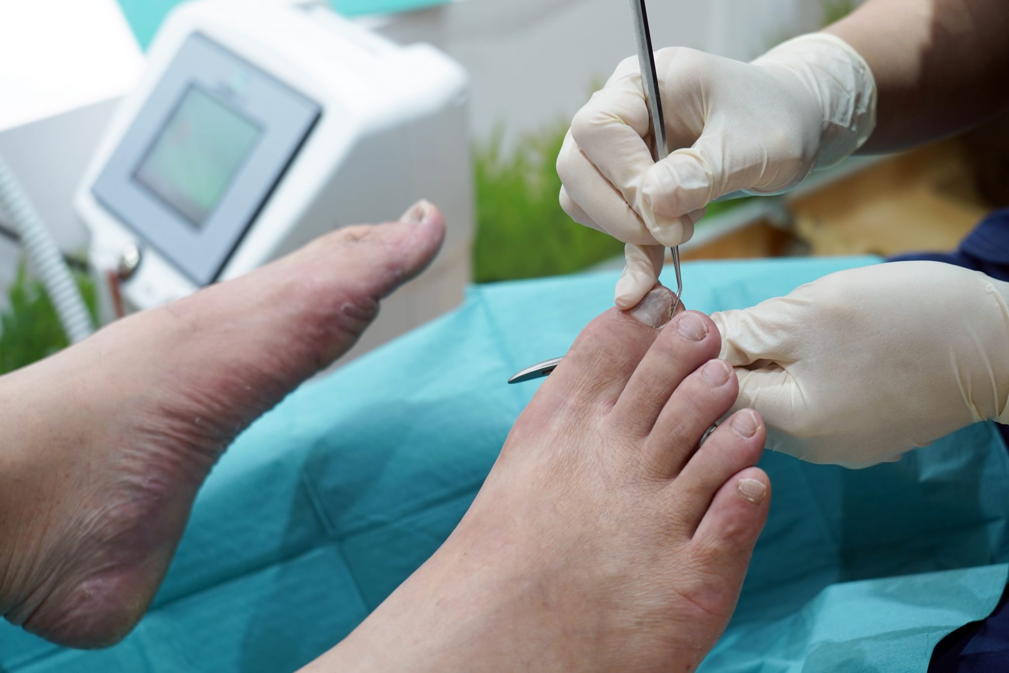 Your Comprehensive Guide To Medical Pedicures