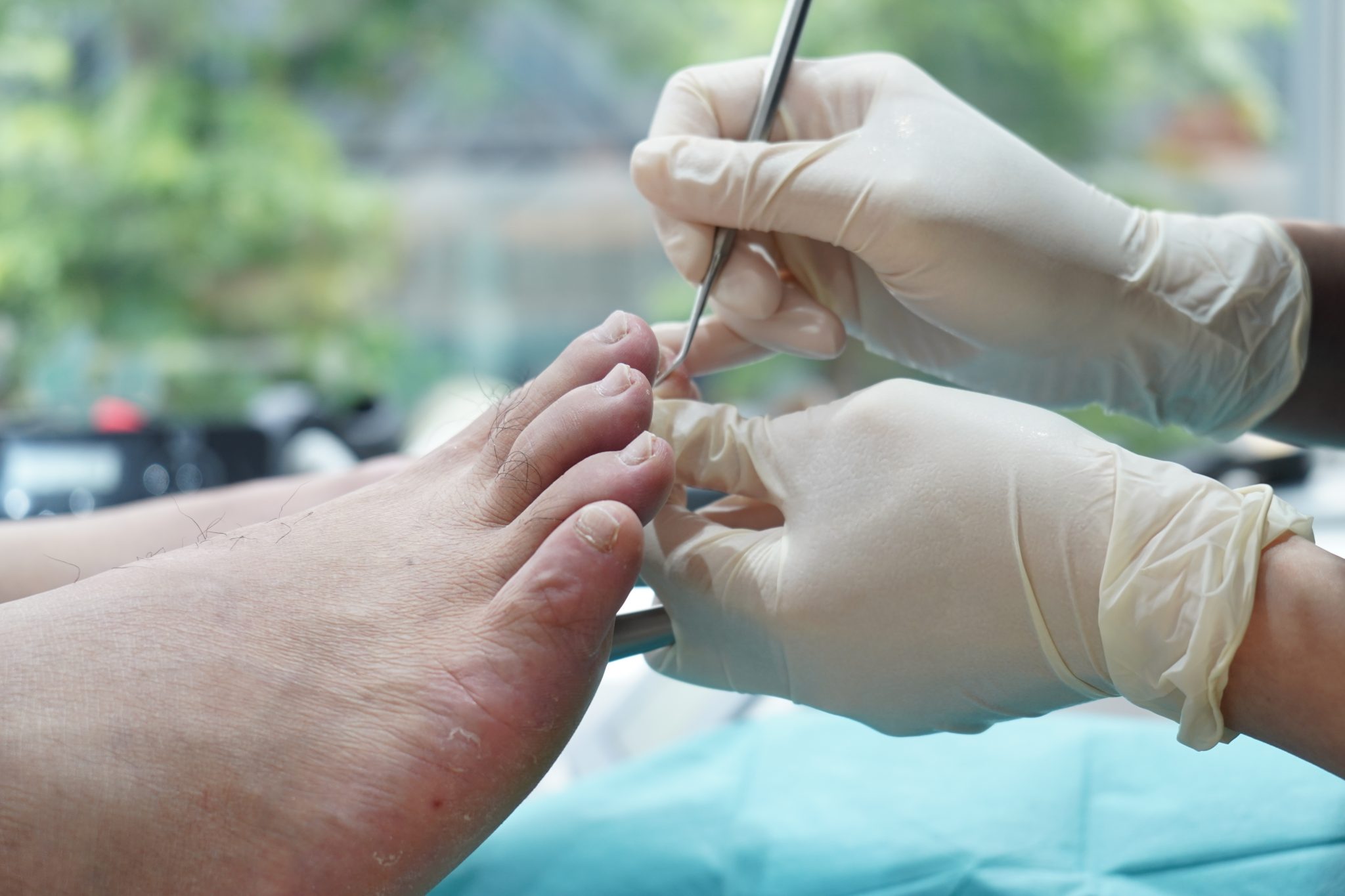 Your Comprehensive Guide To Medical Pedicures